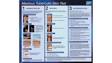 Free Printable Tb Skin Test Form