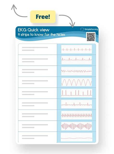 Printable Ekg Cheat Sheet