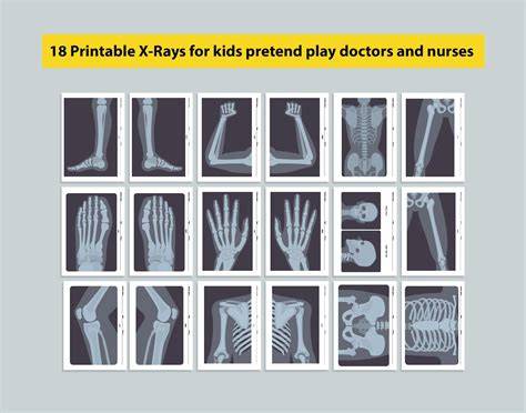 Printable X Rays